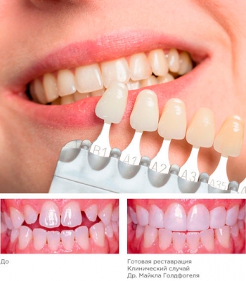 Композит субмикронный гибридный Dentsply Spectrum TPH3 A3,5 шприц 4,5 г Материалы для стоматологии купить в Продез Сочи